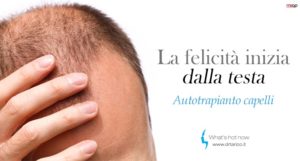 Scopri di più sull'articolo Microchirurgia e Hair Terapy: Autotrapianto dei capelli? la password è FUE!