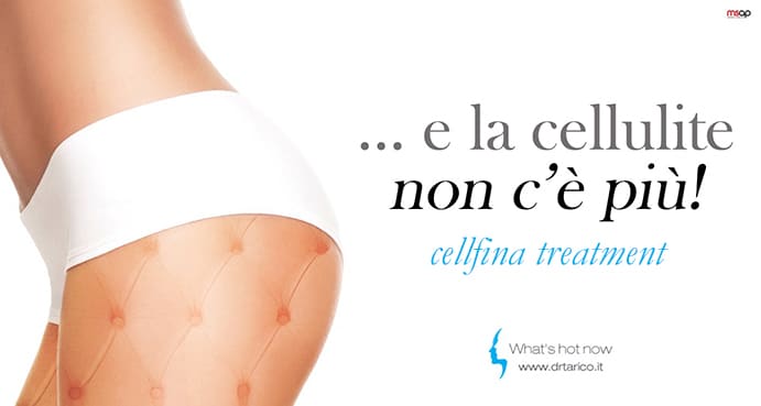 Al momento stai visualizzando …e la cellulite non c’è più