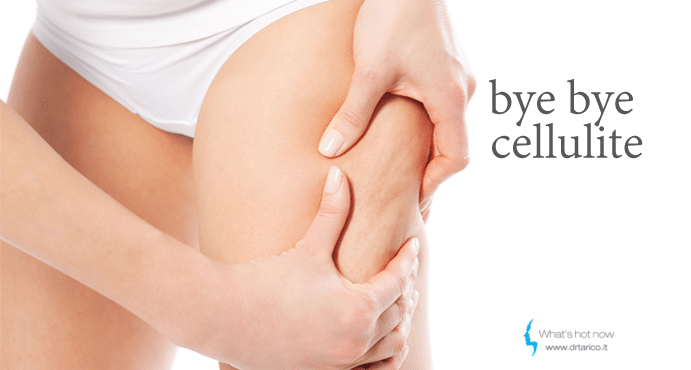 Al momento stai visualizzando La Cellulite. Cos’è, come si elimina.