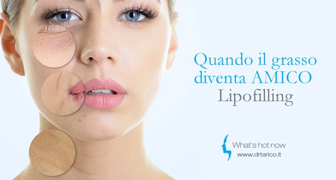 Al momento stai visualizzando E’ Lipo Revolution. Lipofilling del viso, il più rivoluzionario fra i trattamenti anti-aging.