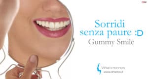 Scopri di più sull'articolo Gummy Smile e Proteina Botulinica: correggere il Sorriso Gengivale senza Chirurgia oggi è possibile.