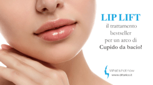 Scopri di più sull'articolo Lip Lift, il trattamento bestseller per un arco di Cupido da bacio!