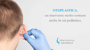 Scopri di più sull'articolo Otoplastica, un intervento molto comune anche in età pediatrica