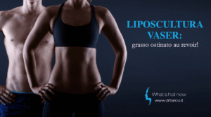 Scopri di più sull'articolo Liposcultura Vaser: grasso ostinato au revoir!