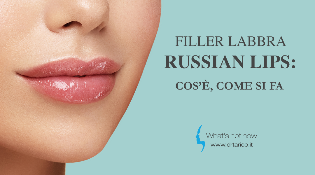 Scopri di più sull'articolo Filler labbra Russian Lips: cos’è, come si fa