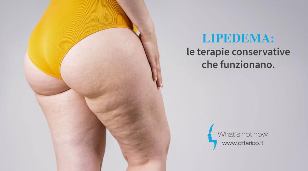 Lipedema, le terapie conservative che funzionano