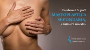 Scopri di più sull'articolo Cambiare? Si può! Mastoplastica secondaria, a tutto c’è rimedio