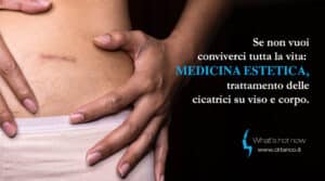 Scopri di più sull'articolo Se non vuoi conviverci tutta la vita: medicina estetica, trattamento delle cicatrici su viso e corpo