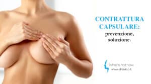 Scopri di più sull'articolo Contrattura capsulare: prevenzione, soluzione