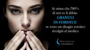 Scopri di più sull'articolo Si stima che l’80% di noi ce li abbia: Granuli di Fordyce, se sono un disagio estetico, rivolgiti al medico