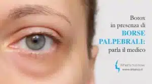 Scopri di più sull'articolo Botox in presenza di borse palpebrali: parla il medico