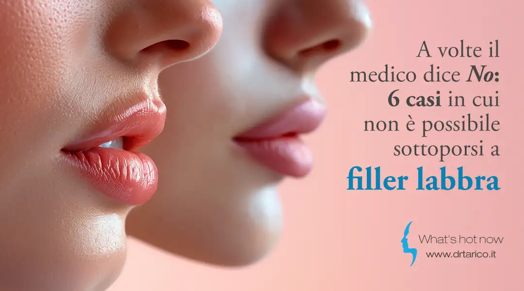 Al momento stai visualizzando A volte il medico dice No: 6 casi in cui non è possibile sottoporsi a filler labbra
