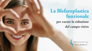 Scopri di più sull'articolo La Blefaroplastica funzionale per curare la riduzione del campo visivo