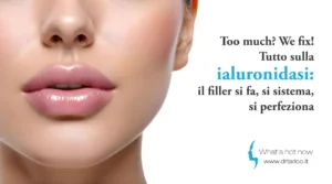 Scopri di più sull'articolo Too much? We fix! Tutto sulla ialuronidasi: il filler si fa, si sistema, si perfeziona