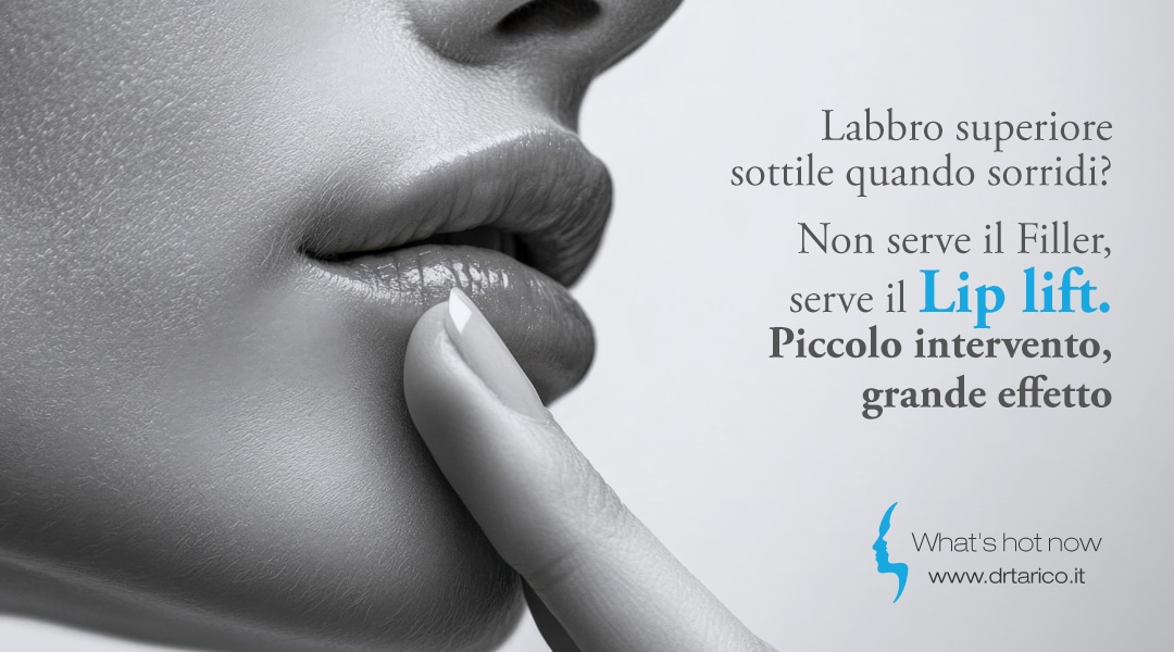 Al momento stai visualizzando Labbro superiore sottile quando sorridi? Non serve il Filler, serve il Lip lift. Piccolo intervento, grande effetto