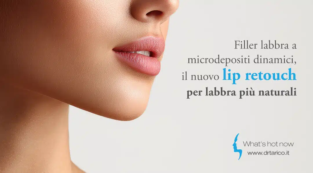 Al momento stai visualizzando Filler labbra a microdepositi dinamici, il nuovo lip retouch per labbra più naturali