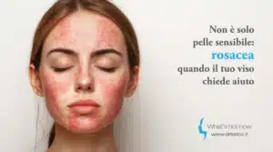 Scopri di più sull'articolo Non è solo pelle sensibile: rosacea, quando il tuo viso chiede aiuto
