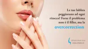 Scopri di più sull'articolo Le tue labbra peggiorano ad ogni ritocco? Forse il problema non è il filler, ma la overcorrection