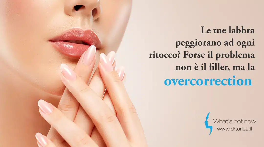 Al momento stai visualizzando Le tue labbra peggiorano ad ogni ritocco? Forse il problema non è il filler, ma la overcorrection